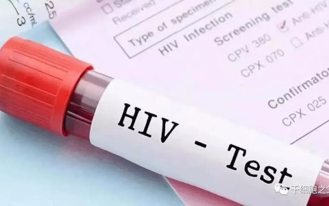 世界第三例艾滋病被治愈，脐带血干细胞移植后她体内的HIV消失了！