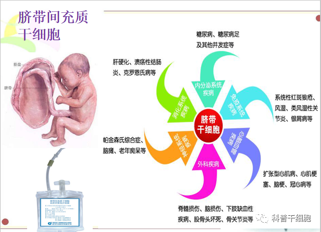 炎症是疾病的罪魁祸首？干细胞有效减轻炎症反应