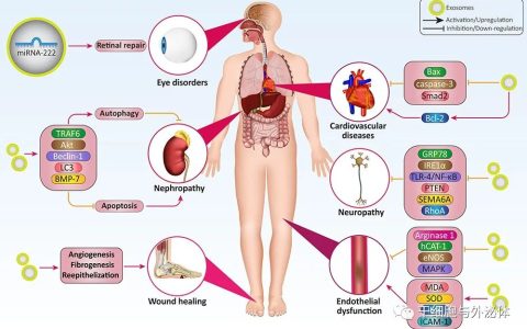 外泌体成为治疗糖尿病的新策略