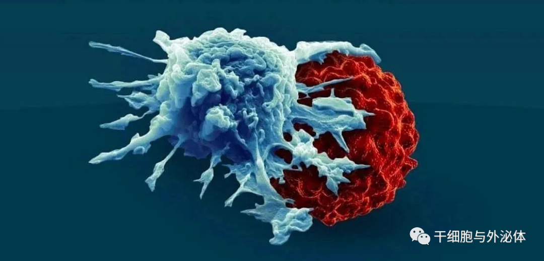 CAR-T细胞疗法在实体瘤中显示出“有限的成功”，但仍在进行“渐进式改变”