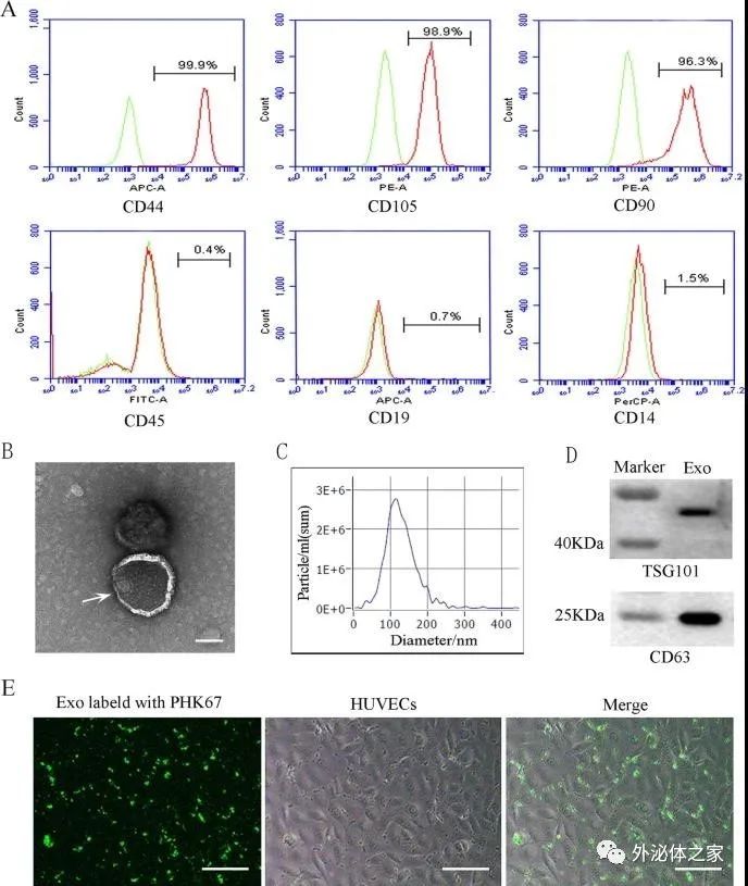 Stem Cell Res Ther | 山东大学口腔医学院：人类乳牙脱落牙干细胞外泌体通过转运miRNAs抑制血管生成