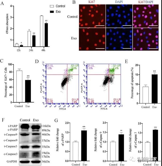 Stem Cell Res Ther | 山东大学口腔医学院：人类乳牙脱落牙干细胞外泌体通过转运miRNAs抑制血管生成