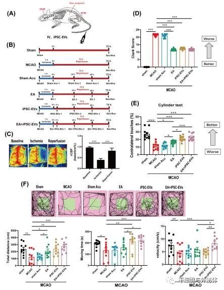 北京协和医院Cells |  穴位电针和人iPS细胞衍生的外泌体联合治疗缺血性脑中风