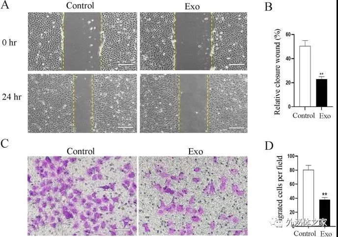 Stem Cell Res Ther | 山东大学口腔医学院：人类乳牙脱落牙干细胞外泌体通过转运miRNAs抑制血管生成