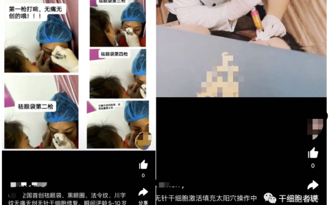 抖音上宣传的“无针干细胞” 到底是怎么一回事