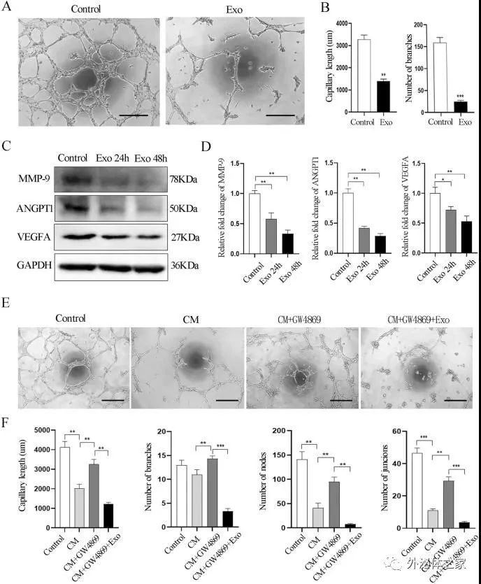 Stem Cell Res Ther | 山东大学口腔医学院：人类乳牙脱落牙干细胞外泌体通过转运miRNAs抑制血管生成