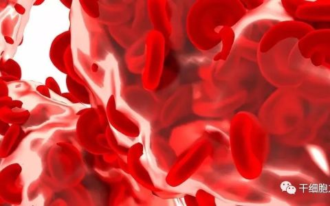 临床研究丨人脐带血单个核细胞的应用前景