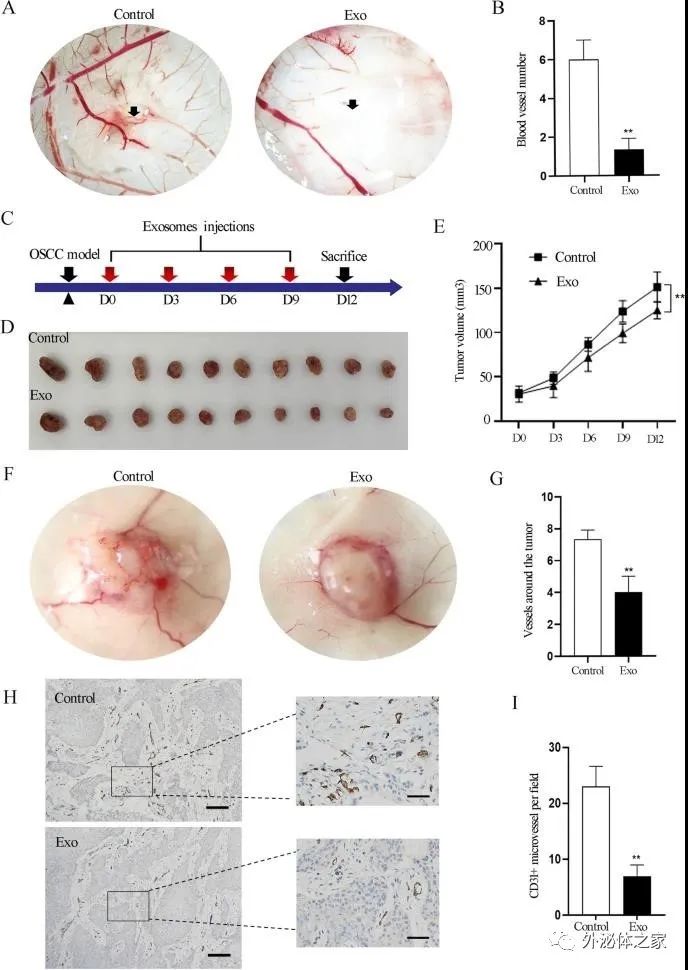 Stem Cell Res Ther | 山东大学口腔医学院：人类乳牙脱落牙干细胞外泌体通过转运miRNAs抑制血管生成