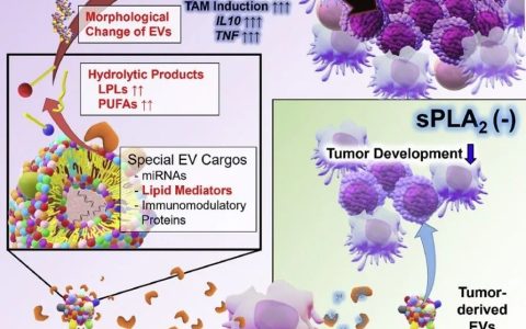 Cell Metab丨分泌型磷脂酶A2通过水解细胞外囊泡促进淋巴瘤生长