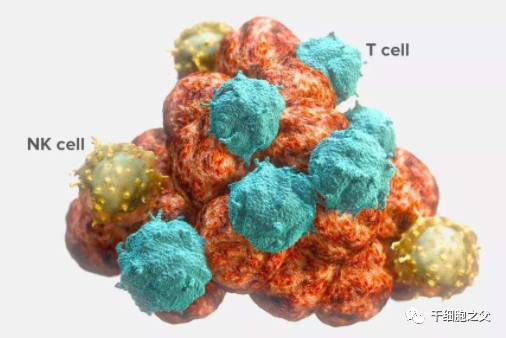 NK细胞杀伤力有多强？仅用21天就消灭了实体瘤！