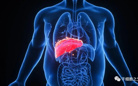 《柳叶刀》子刊580万人数据：脂肪肝不只是伤肝，干细胞改善肝功能效果显著