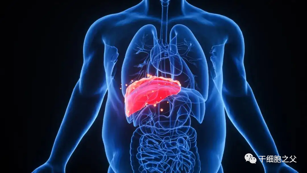 《柳叶刀》子刊580万人数据：脂肪肝不只是伤肝，干细胞改善肝功能效果显著