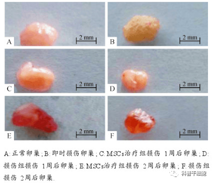 干细胞逆转更年期，让女性保持美丽与优雅