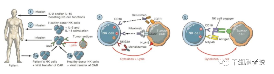 免疫细胞治疗“新力量：NK细胞疗法