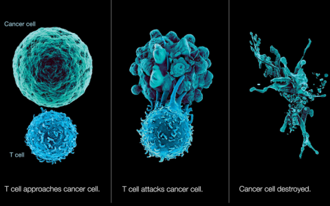 免疫细胞治疗“新力量：NK细胞疗法