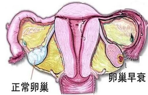 【干细胞】改善卵巢功能