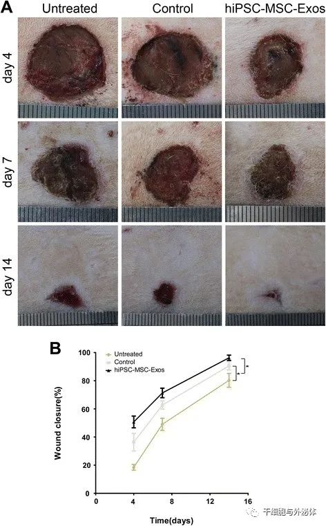 皮肤科 | hiPSC-MSCs外泌体促进皮肤胶原蛋白、弹性蛋白合成和组织修复