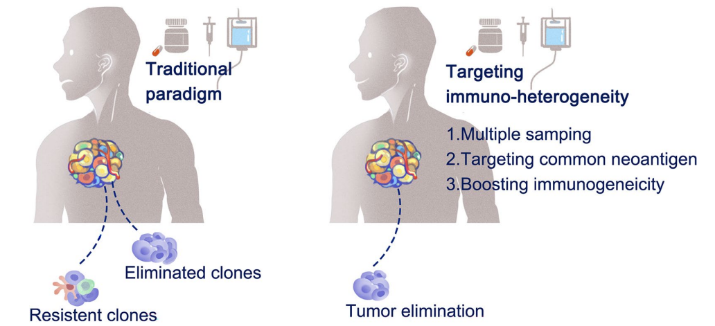 肿瘤免疫微环境的异质性及其临床意义