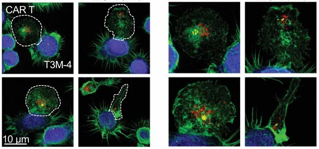 盘点：CAR-T细胞疗法最新研究进展