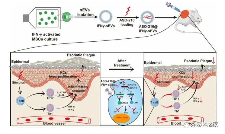 Front Cell Dev Bio|中山大学程芳/陈红波课题组：脐带间充质干细胞来源外泌体负载ASO-210用于缓解银屑病进展