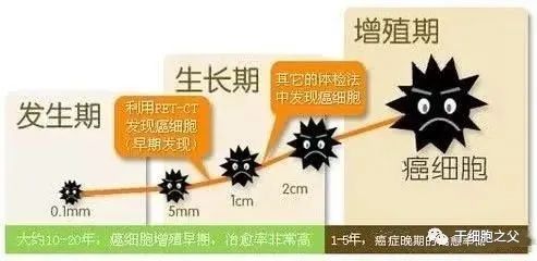 癌症的绿色疗法： NK细胞免疫疗法