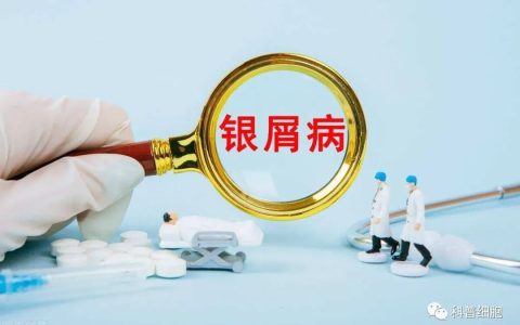干细胞 | 治疗银屑病临床研究进展