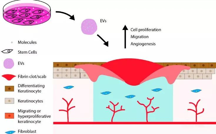 科普日谈丨皮损修复的新宠-外泌体