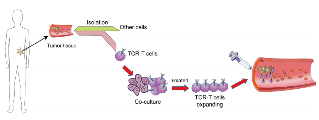 细胞治疗的前沿领域：TCR-T细胞疗法