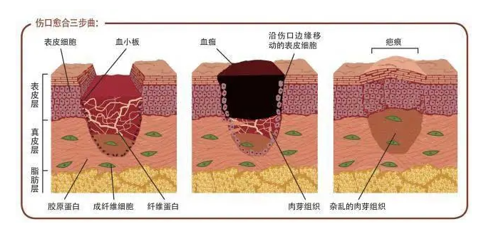 科普日谈丨皮损修复的新宠-外泌体