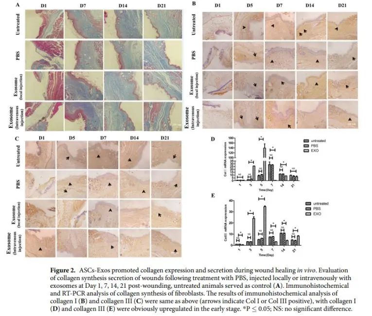 科普日谈丨皮损修复的新宠-外泌体