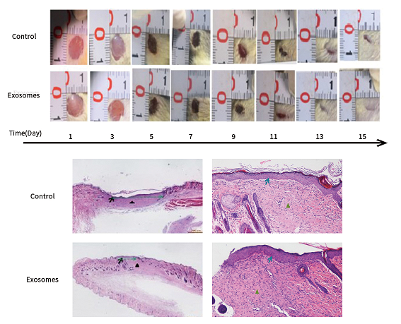 科普日谈丨皮损修复的新宠-外泌体