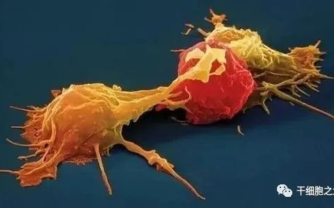 抗癌“新星”—NK细胞疗法的临床研究新进展