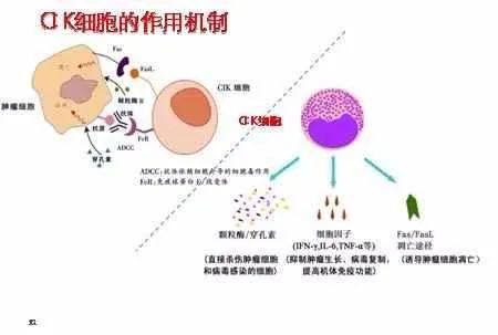 除了120万一针的CAR-T，还有两大抗癌疗法CIK、NK，你都分得清吗？