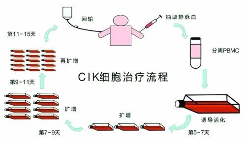 除了120万一针的CAR-T，还有两大抗癌疗法CIK、NK，你都分得清吗？