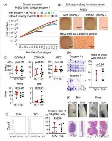 5年随访证实：干细胞治疗慢性膝关节炎疼痛安全有效