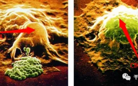 同样是免疫细胞，CIK细胞和NK细胞有什么区别？