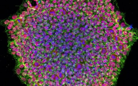 全球CDMO巨头Catalent​布局iPS细胞领域，建立iPS细胞系解决细胞疗法免疫原性问题
