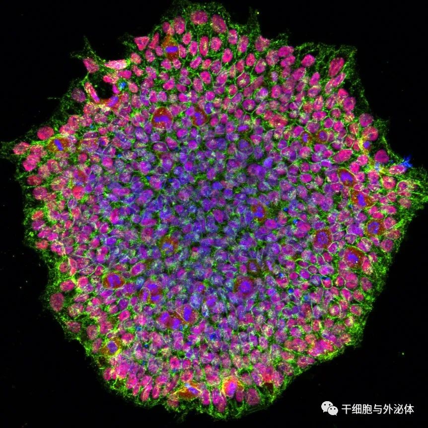 全球CDMO巨头Catalent​布局iPS细胞领域，建立iPS细胞系解决细胞疗法免疫原性问题