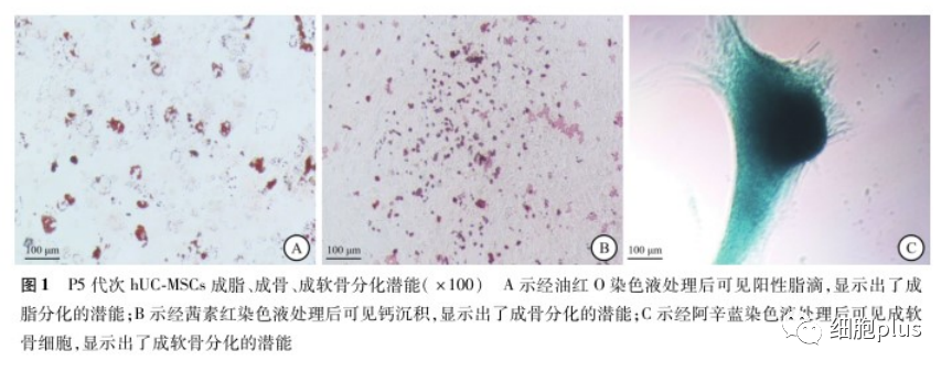 同是脐带间充质干细胞也有不一样的地方 临床效果当然有差异