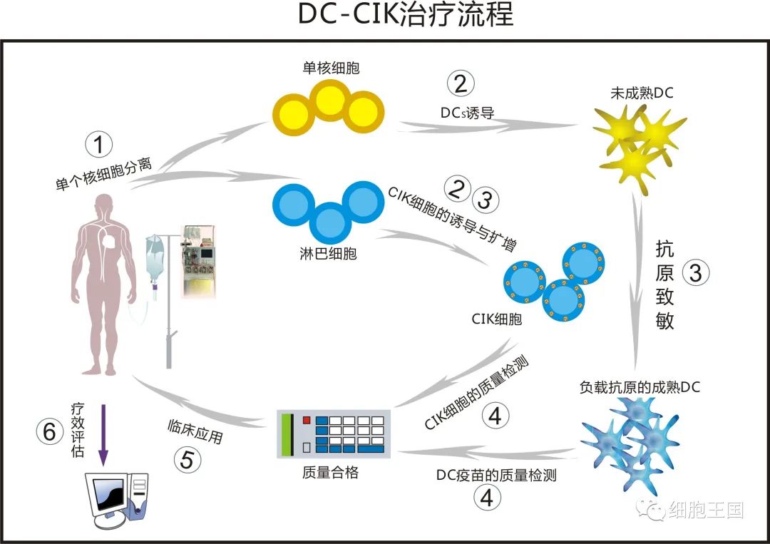 抗癌免疫细胞疗法：DC、CIK、NK、TIL、γδT... 有何不同？