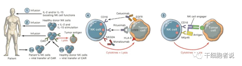 免疫细胞治疗“新力量”：NK细胞疗法