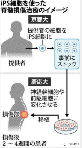 一文尽览：干细胞领域重要研究成果