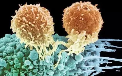 看看免疫细胞如何攻击宫颈癌细胞，从此不再“谈癌色变”