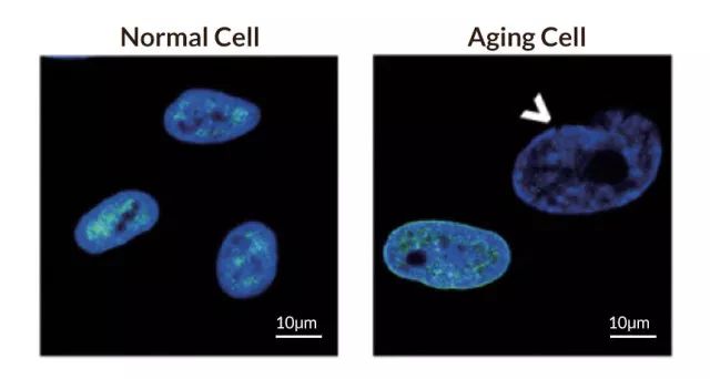 十大值得关注的抗衰老研究