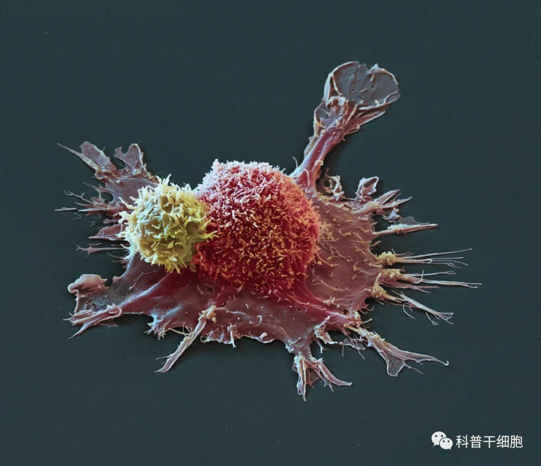 11组高清动画美图带你看“免疫细胞”追击“癌细胞”