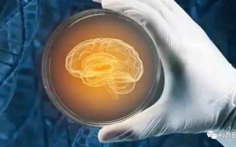 干细胞可以治疗脑出血吗？