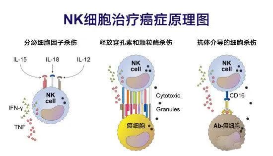 NK细胞疗法：防癌抗癌中必不可少的利器！