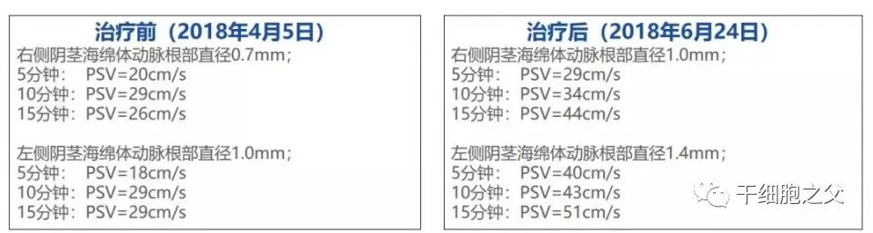 人至中年遭遇ED危机，干细胞重塑男性雄风