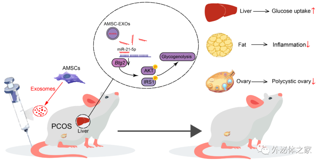 Biomaterials | 吉林大学周虚、李纯锦团队：脂肪间充质干细胞外泌体通过防止代谢紊乱改善多囊卵巢综合征