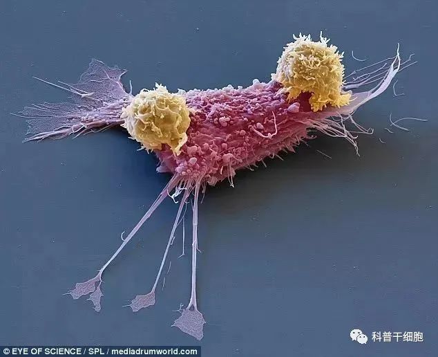 11组高清动画美图带你看“免疫细胞”追击“癌细胞”